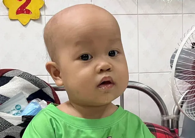 Xót xa bé gái 3 tuổi bị ung thư