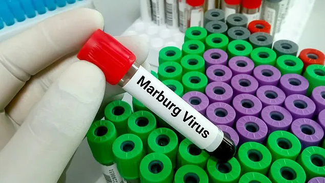 Bùng phát virus Marburg ở Tanzania