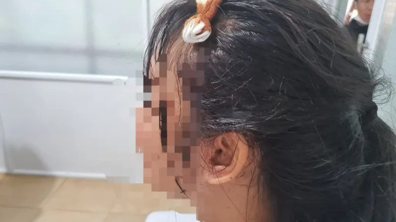 Đắk Lắk: Một nữ sinh bị đánh hội đồng