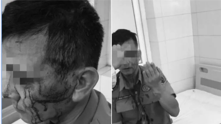 Bảo vệ Bệnh viện K bị đánh vỡ đầu khi ngăn cản “cò” 