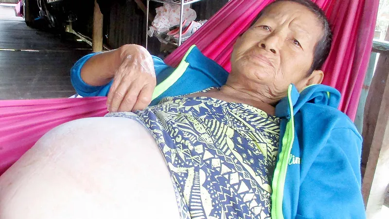 Mắc bệnh nan y, không tiền chữa trị