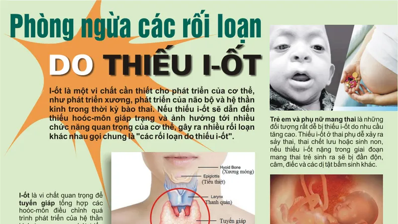 Cần bổ sung dinh dưỡng phù hợp phong ngừa thiếu i-ốt