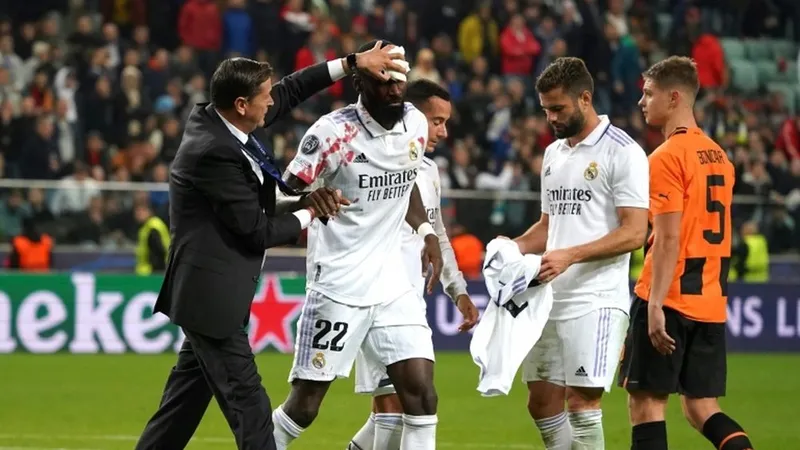 Antonio Rudiger phải khâu đến 20 mũi sau ca tét đầu