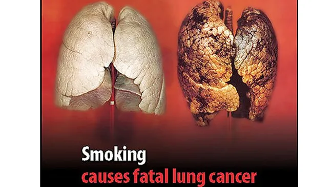Các hãng thuốc lá Mỹ tự thú về tác hại của hút thuốc