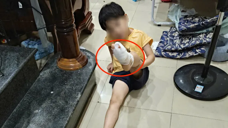“Vật lạ” cứa chân người dân khi tắm biển ở Nha Trang