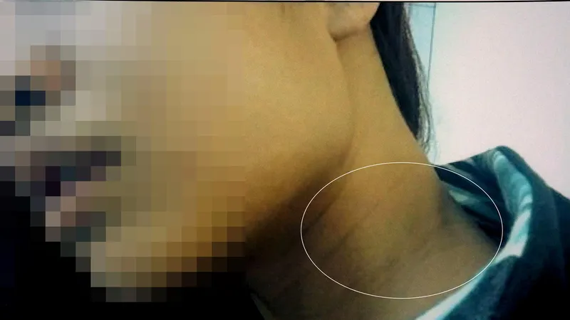 Chị Tr. với vết thương trên người. Ảnh: C.T.