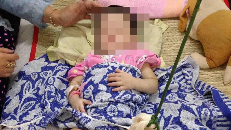 Bé gái 2 tuổi bị mẹ nuôi đánh gãy chân