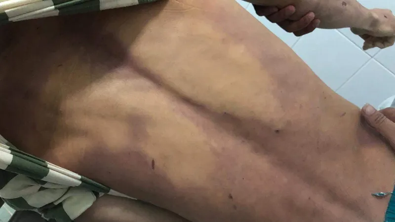 Bác sĩ xác định Dân đã tử vong trước khi nhập viện. Ảnh: VŨ PHONG 