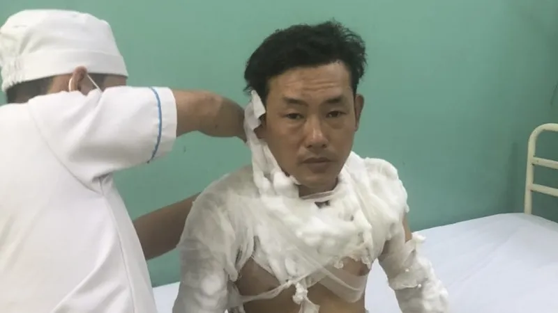 Tài khai cướp ngân hàng do nợ tiền chơi số đề khoảng 200 triệu đồng 