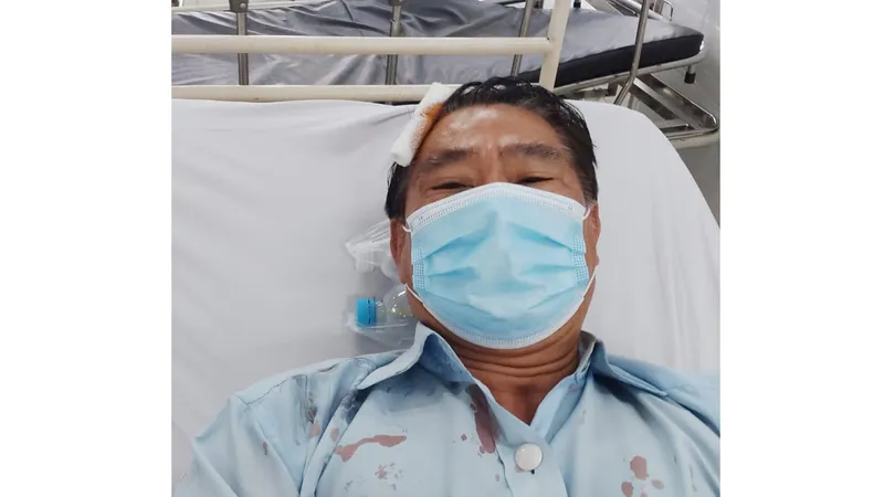 Nạn nhân điều trị ở bệnh viện 
