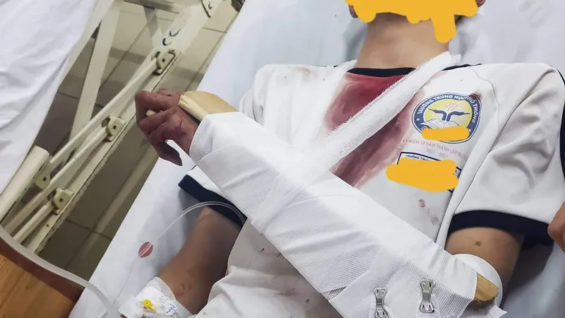 Nam sinh với thương tích trên người 