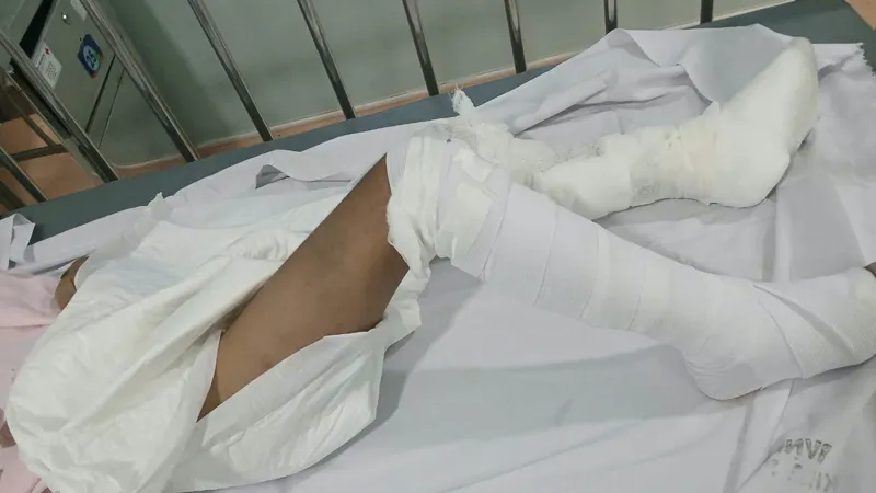Vết thương trên người bé trai được băng bó