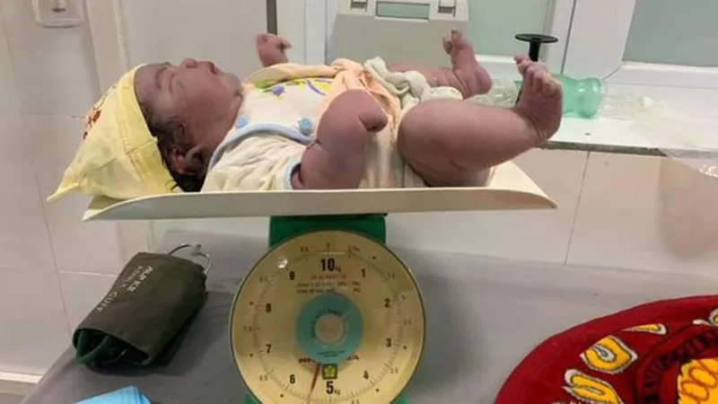 Sản phụ sinh thường bé nặng 5,5kg