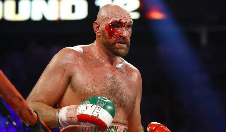 Fury đổ máu trong trận thắng Wallin