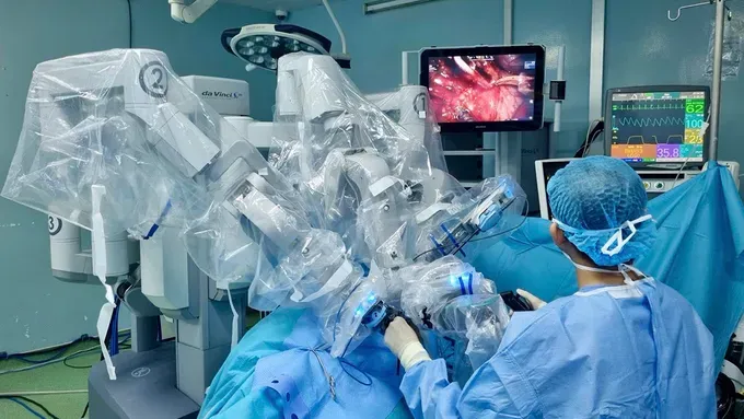 A robotic surgery session at Binh Dan Hospital (Photo: SGGP)