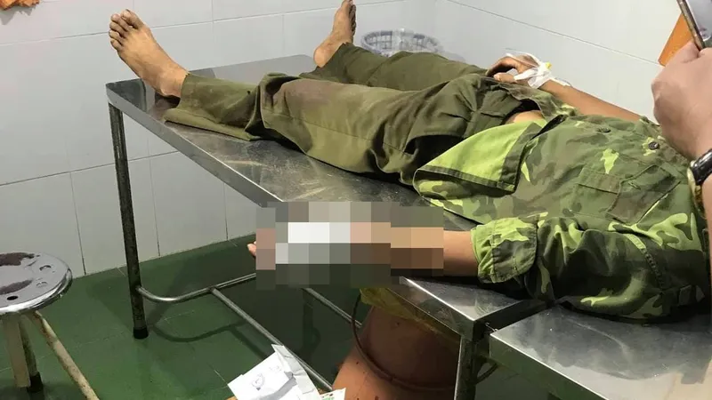 Giải cứu đồng bọn, hàng chục lâm tặc vây, chém lực lượng kiểm lâm
