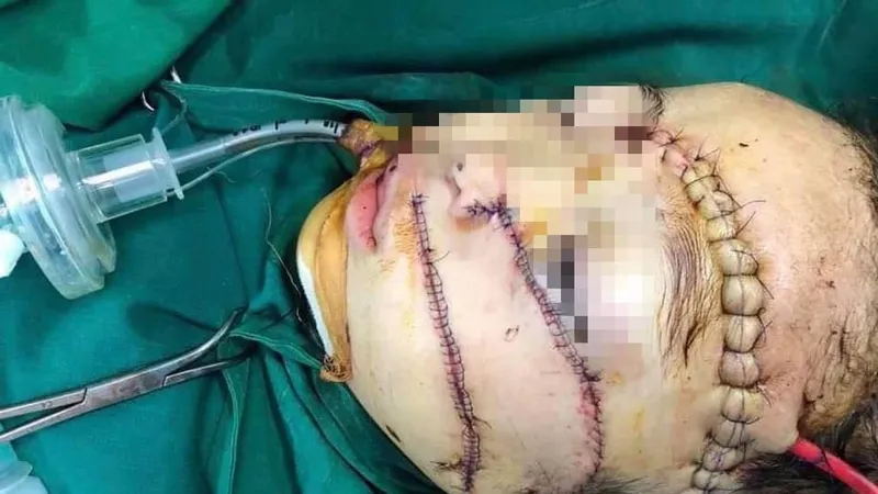 Khâu gần 300 mũi, cứu sống cháu bé bị cha chém nguy kịch