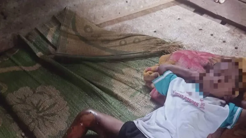 Bé 8 tuổi nghi bị tẩm xăng đốt do không chịu đi ăn trộm 