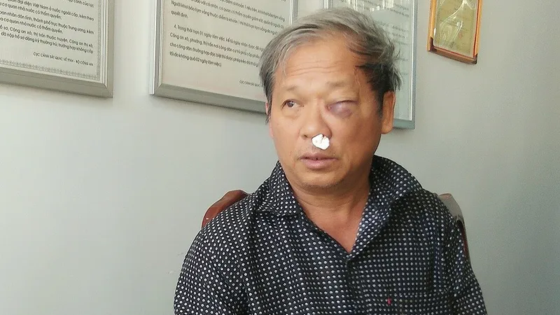 Phóng viên bị đánh dã man sau khi báo tin khai thác đất trái phép
