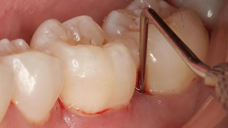 Cấp cứu thành công ca tai biến y khoa hiếm gặp