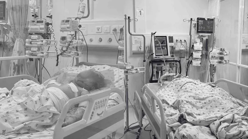 Cấp cứu hai trẻ bỏng nặng, nghi bị cha ruột phóng hỏa