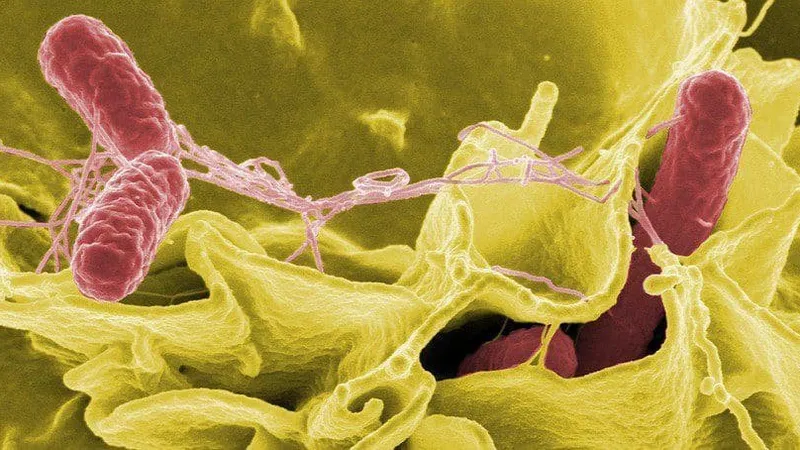 Tìm thấy vi khuẩn Salmonella trong mẫu bệnh phẩm của bé trai ngộ độc bánh mì