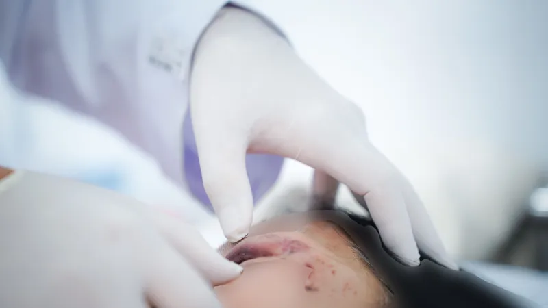 Tai nạn giao thông trên đường hành hương, 4 người bị thương nặng