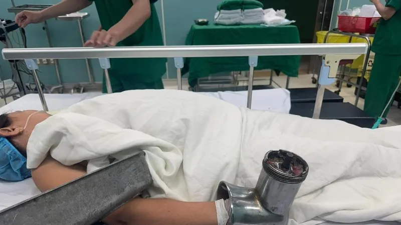 Sốc với hình ảnh người phụ nữ nhập viện cùng chiếc máy xay thịt 