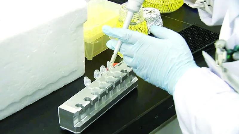 Sử dụng huyết thanh có thể giúp chẩn đoán chứng thoái hóa thần kinh 