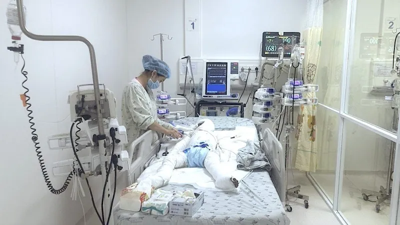Gần 100 ngày giành giật sự sống cho bé trai 6 tuổi bị bỏng nặng