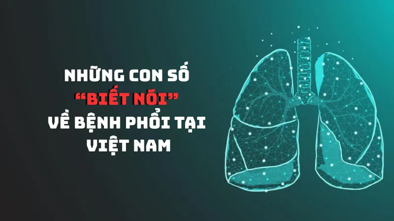 Những con số "biết nói" về bệnh phổi tại Việt Nam