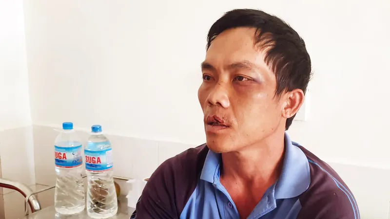 Người của chủ đầu tư dự án điện mặt trời bắt dân trói, hành hung, phơi nắng