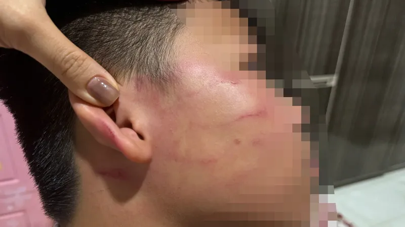 Vụ học sinh lớp 4 bị tát ở Gia Lai: Điểm dạy thêm hoạt động không phép