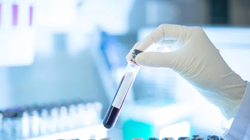 Xét nghiệm máu phát hiện sớm đa ung thư của Grail trên lộ trình xin được FDA cấp phép