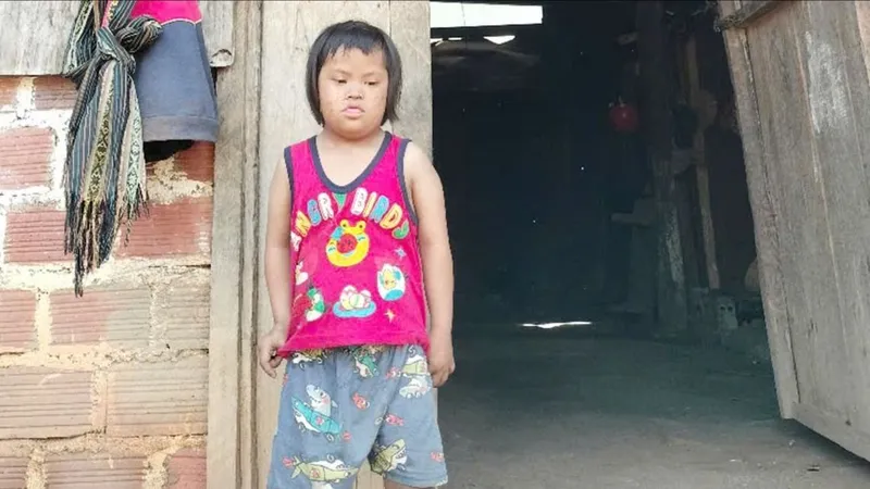 Trao tiền hỗ trợ cháu bé bị câm, bệnh tim