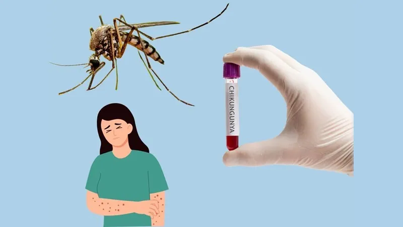 Triệu chứng bệnh Chikungunia xuất hiện sau 4-8 ngày từ khi muỗi Aedes nhiễm bệnh đốt