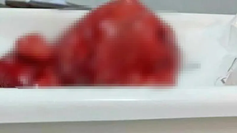Phẫu thuật thành công khối u xơ nặng 4,5kg trong tử cung người phụ nữ 60 tuổi