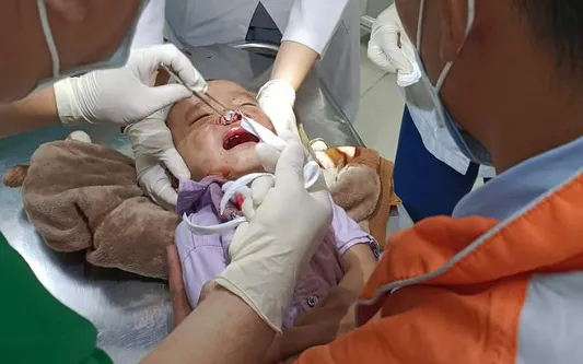 Làm rõ vụ người dân tố CSGT đánh cháu bé 3 tuổi nứt xương mặt