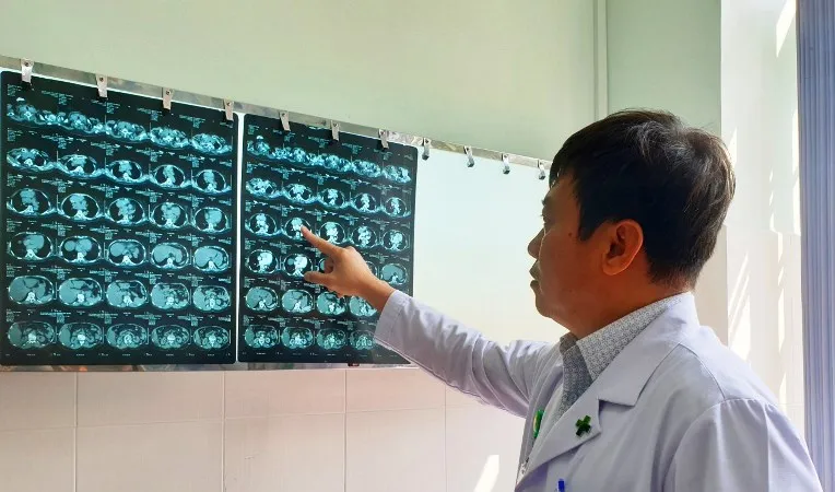 Phẫu thuật thành công bướu giáp thòng từ cổ xuống ngực