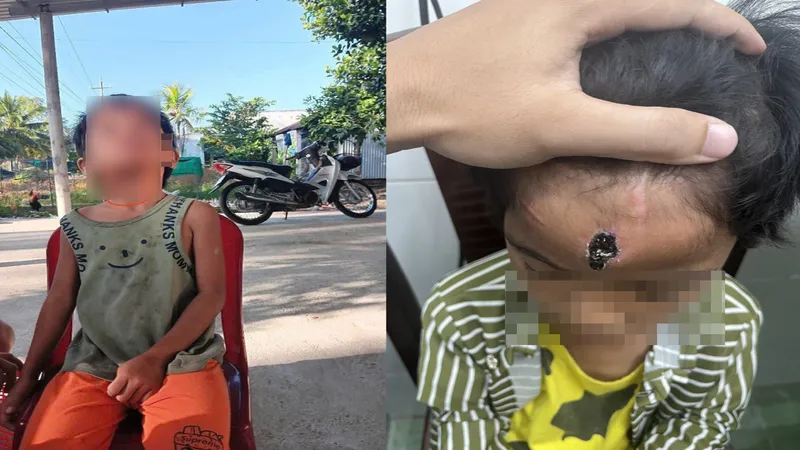Kiên Giang: Khởi tố “cha dượng” hành hạ con riêng của vợ