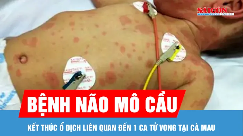 Kết thúc ổ dịch bệnh não mô cầu liên quan đến 1 ca tử vong ở Cà Mau