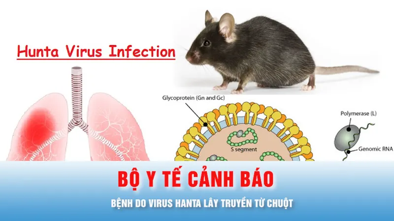 Podcast bản tin chiều 5-5: Bộ Y tế cảnh báo về bệnh do virus Hanta lây truyền từ chuột