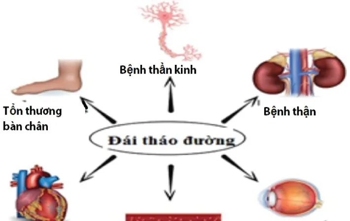 ​Khắc tinh của tiểu đường