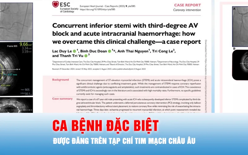 Podcast bản tin trưa 14-9: Ca bệnh đặc biệt tại TPHCM được đăng trên tạp chí tim mạch châu Âu