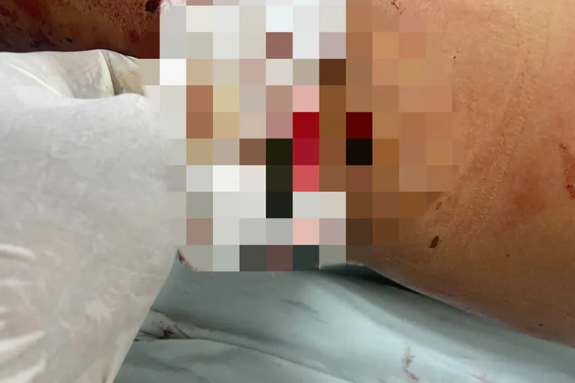 Người đàn ông đang được cấp cứu tại bệnh viện với vết thương nặng