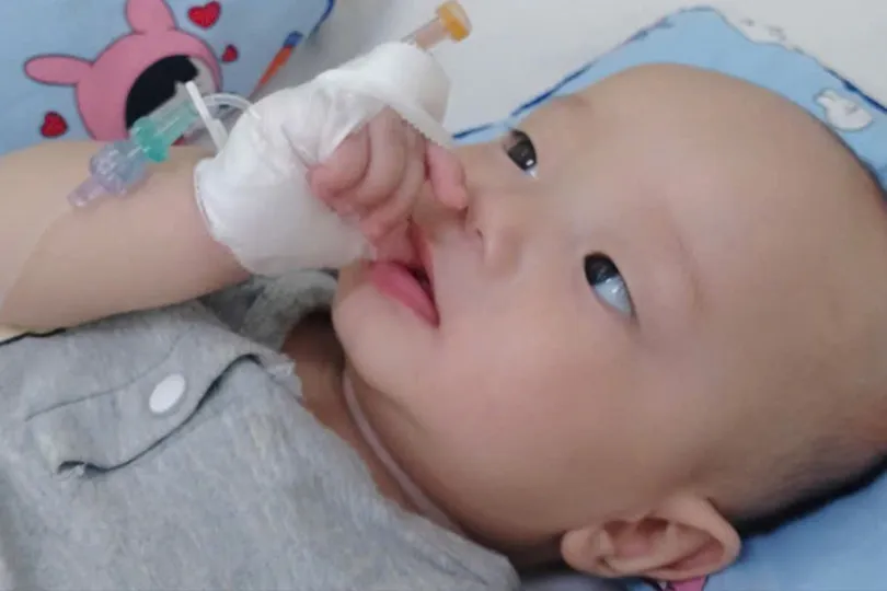 Bé trai 6 tháng tuổi bị viêm tủy cột sống, nguy cơ bại liệt