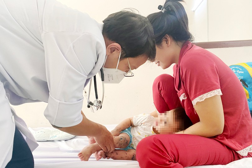 第二儿童医院医生为患有手足口病的病儿进行检查。