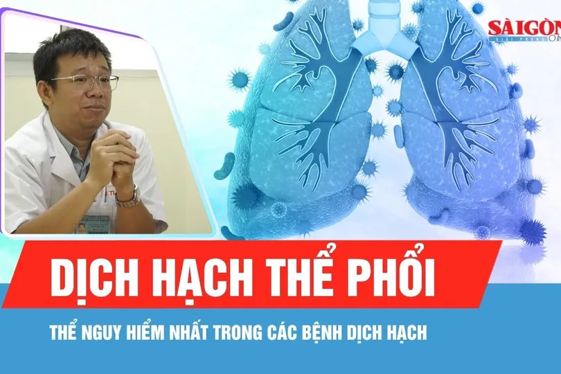 Dịch hạch tại Nga: Có đáng lo ngại?