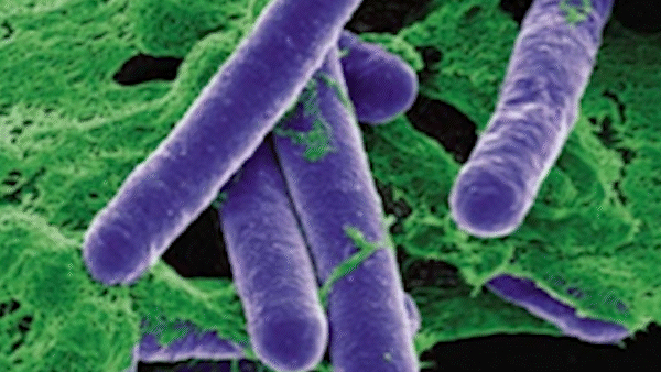 TPHCM: 2 ca nghi ngờ ngộ độc botulinum đã cai máy thở