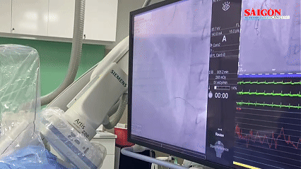 Các bác sĩ phẫu thuật cho người bệnh